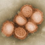 Virus